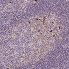 Anti-PTPRJ Antibody