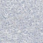 Immunohistochemical staining of human liver shows low positivity in hepatocytes as expected.