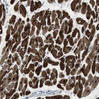 Immunohistochemical staining of human heart muscle shows strong cytoplasmic and nuclear positivity in cardiomyocytes.
