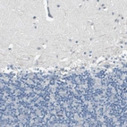 Immunohistochemical staining of human cerebellum shows low positivity as expected.