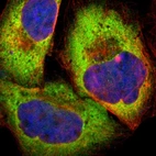 Immunofluorescent staining of human cell line A-431 shows localization to cytosol.