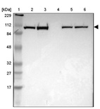Lane 1: Marker [kDa] 229, 112, 84, 48, 32, 27, 17_br/_Lane 2: Human cell line RT-4_br/_Lane 3: Human cell line U-251MG sp_br/_Lane 4: Human plasma (IgG/HSA depleted)_br/_Lane 5: Human liver tissue_br/_Lane 6: Human tonsil tissue
