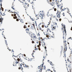 Anti-NCF2 Antibody