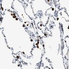 Immunohistochemical staining of human lung shows strong cytoplasmic positivity in macrophages.