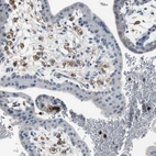 Immunohistochemical staining of human placenta shows moderate to strong cytoplasmic positivity in lymphoid cells.