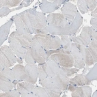 Immunohistochemical staining of human skeletal muscle shows no positivity in myocytes as expected.