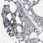 Immunohistochemical staining of human bone marrow shows strong cytoplasmic positivity in hematopoietic cells.