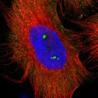 Immunofluorescent staining of human cell line U-251 MG shows localization to nucleoli & cytosol.
