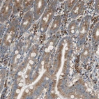 Immunohistochemical staining of human duodenum shows moderate cytoplasmic/cytoplasmic-membranous positivity in glandular cells.