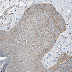 Anti-RPL35 Antibody