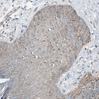 Immunohistochemical staining of human skin shows weak cytoplasmic/cytoplasmic-membranous positivity in squamous epithelial cells.