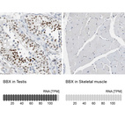 Anti-BBX Antibody