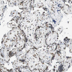 Immunohistochemical staining of human placenta shows weak to moderate nuclear positivity in trophoblastic cells.