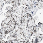 Immunohistochemical staining of human placenta shows weak to moderate nuclear positivity in trophoblastic cells.