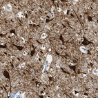 Immunohistochemical staining of human cerebral cortex shows strong cytoplasmic and nuclear positivity in neurons.