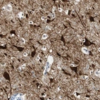 Immunohistochemical staining of human cerebral cortex shows strong cytoplasmic and nuclear positivity in neurons.