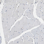 Immunohistochemical staining of human skeletal muscle shows no positivity in myocytes as expected.