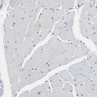 Immunohistochemical staining of human skeletal muscle shows no positivity in myocytes as expected.