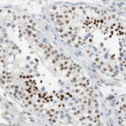 Immunohistochemical staining of human testis shows moderate to strong nuclear positivity in cells in seminiferous ducts.