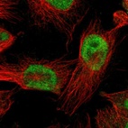 Immunofluorescent staining of human cell line U-251 MG shows localization to nucleoplasm.