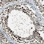 Immunohistochemical staining of human testis shows strong nuclear positivity in cells in seminiferous ducts.