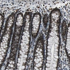 Immunohistochemical staining of human rectum shows strong nuclear positivity in glandular cells.