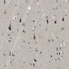 Immunohistochemical staining of human cerebral cortex shows strong nuclear positivity in neurons.