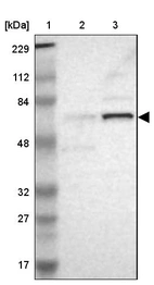 Lane 1: Marker [kDa] 229, 112, 84, 48, 32, 27, 17_br/_Lane 2: Human cell line RT-4_br/_Lane 3: Human cell line U-251MG sp