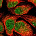 Immunofluorescent staining of human cell line U-2 OS shows localization to nucleoplasm, nuclear bodies & cytosol.