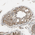 Anti-MRPS22 Antibody