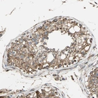 Immunohistochemical staining of human testis shows moderate granular cytoplasmic positivity in cells in seminiferous ducts.