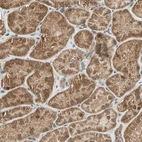 Immunohistochemical staining of human kidney shows moderate granular cytoplasmic positivity in cells in tubules.
