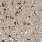 Anti-MRPS22 Antibody