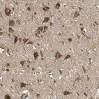 Immunohistochemical staining of human cerebral cortex shows strong granular cytoplasmic positivity in neurons.