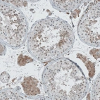 Immunohistochemical staining of human Testis shows moderate nuclear positivity in cells in seminiferous ducts.