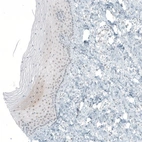 Immunohistochemical staining of human Cervix shows very weak nuclear positivity in squamous epithelial cells.