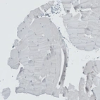 Immunohistochemical staining of human Skeletal muscle shows no positivity in myocytes as expected.