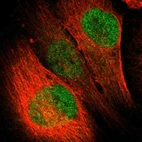 Immunofluorescent staining of human cell line U-251 MG shows localization to nucleoplasm.