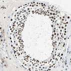 Anti-KAT6B Antibody