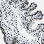 Immunohistochemical staining of human fallopian tube shows moderate to strong nuclear positivity in glandular cells.
