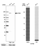 Western blot analysis in human cell line PC-3 and human cell line RT-4.