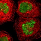 Immunofluorescent staining of human cell line A-431 shows localization to nucleus & nuclear bodies.