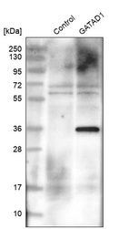 Anti-GATAD1 Antibody