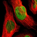 Immunofluorescent staining of human cell line U-2 OS shows localization to nucleoplasm.