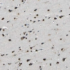 Immunohistochemical staining of human cerebral cortex shows strong nuclear positivity in glial cells.