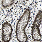 Anti-NFIA Antibody