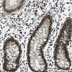 Immunohistochemical staining of human colon shows strong nuclear positivity in glandular cells.