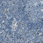 Immunohistochemical staining of human lymph node shows strong nuclear positivity in non-germinal center cells.