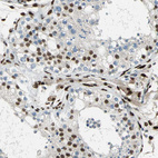 Anti-NFIA Antibody