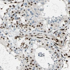 Immunohistochemical staining of human testis shows strong nuclear positivity in Leydig cells.
